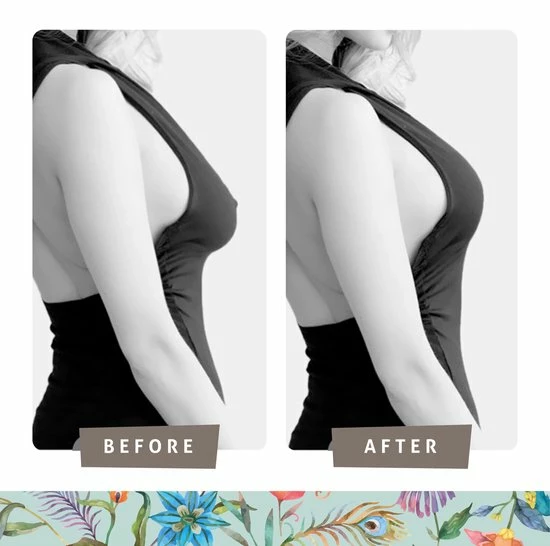 VitalJoy Boob Tape – Boobtape – BH Tape – Fashion Tape – 5 Meter – Zwart – 5 Cm Breed 5 VitalJoy Boob Tape – Boobtape – BH Tape – Fashion Tape – 5 Meter – Zwart – 5 Cm Breed - Afbeelding 3